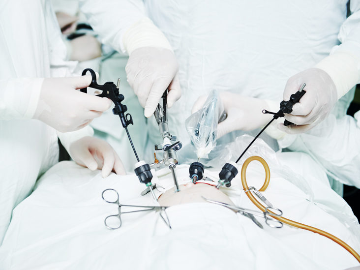 Best Endoscopic Surgeon in Gurgaon